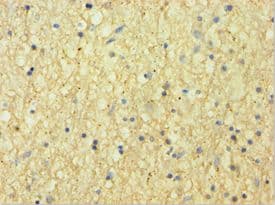 Polyclonal Rabbit anti-Human CNDP1 Antibody (aa1-280, IHC, WB)