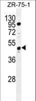 Polyclonal Rabbit anti-Human C7orf72 Antibody (aa410-438, WB)