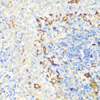 Polyclonal Rabbit anti-Human NAMPT / Visfatin Antibody (IHC, IF, WB)