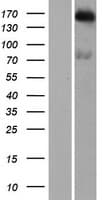 Human KIAA0476 / DENND4B Protein (Over-Expression Lysate Myc-DDK (Flag))