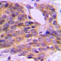 PRKCQ / PKC-Theta Antibody (phospho-Ser676)