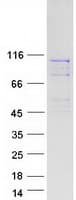 Human BBS9 Protein (Recombinant Myc-DDK (Flag))