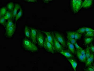 Polyclonal Rabbit anti-Human RIP1 / RALBP1 Antibody (IHC, IF, WB)