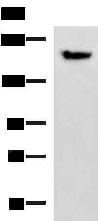 PDS5B / AS3 Antibody