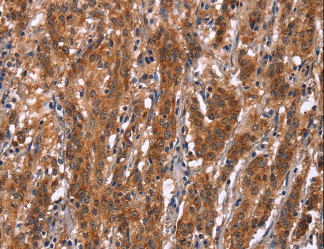 Polyclonal Rabbit anti-Human Gephyrin Antibody (IHC)