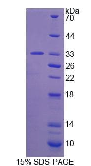 Mouse CA13 / Carbonic Anhydrase XIII Protein (Recombinant)