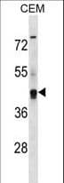 Polyclonal Rabbit anti-Human KCNG2 Antibody (aa149-177, WB)