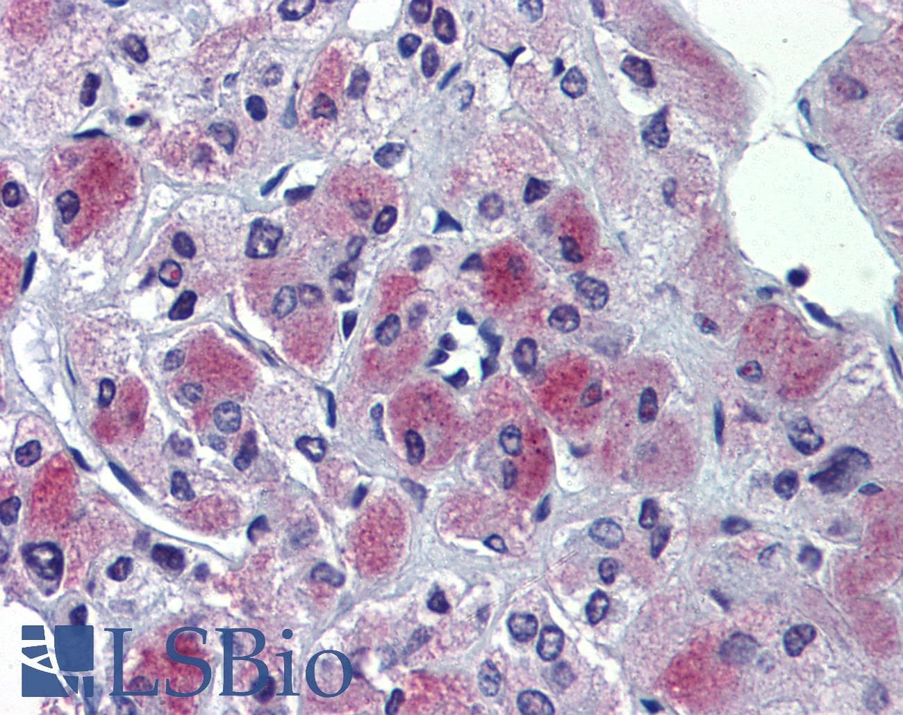 IHC-plus™ GLE1 Antibody