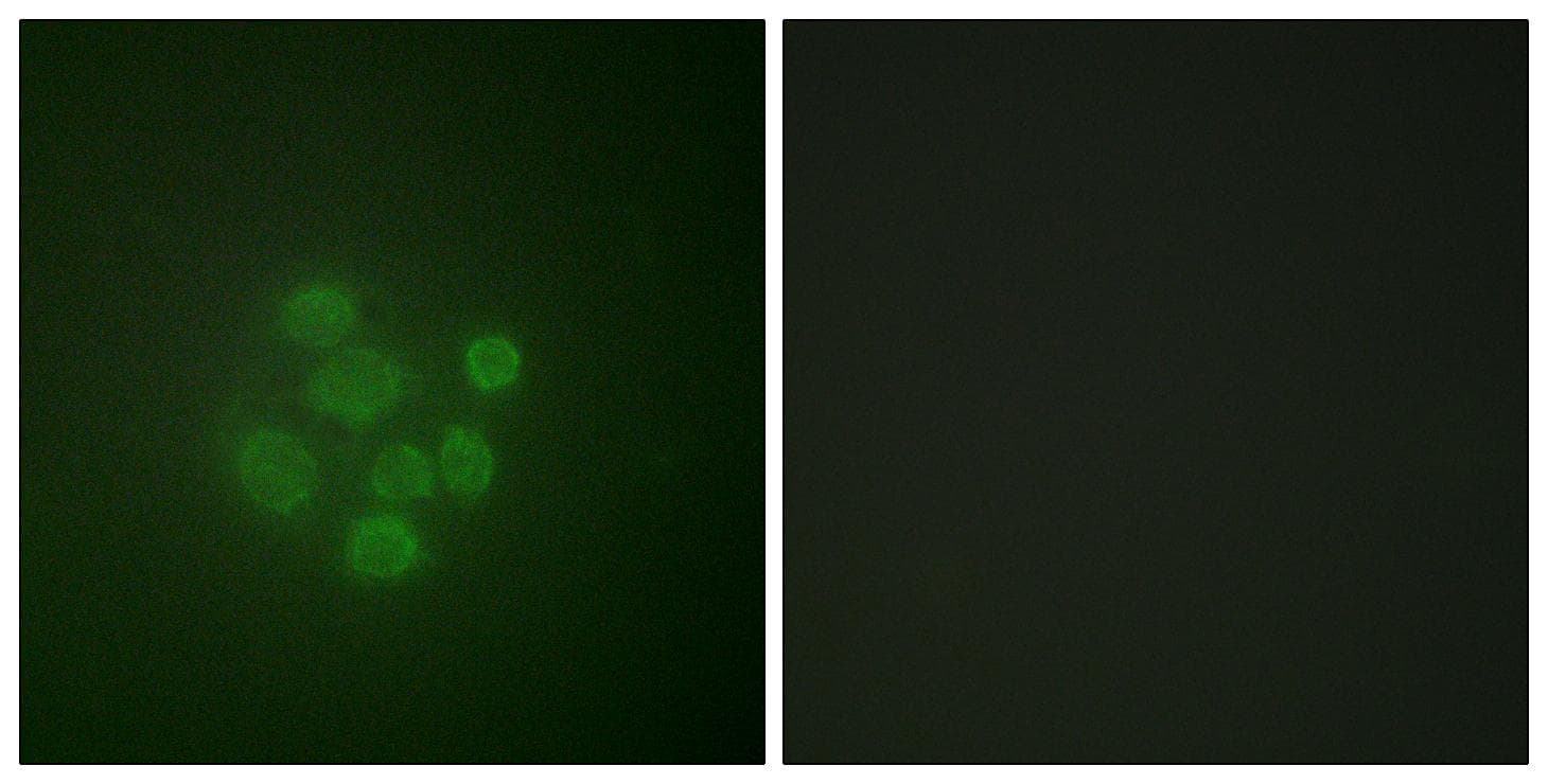 MDM2 Antibody (phospho-Ser166)