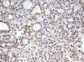 Monoclonal Mouse anti-Human MORF4 Antibody (clone OTI5A8, Carrier-free, aa1-255, IHC, WB)