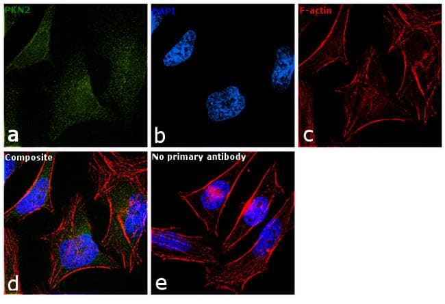 PKN2 Antibody (clone 1D1)