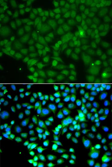 Polyclonal Rabbit anti-Human FRK Antibody (IHC, IF, WB)