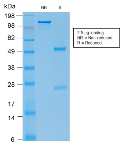 PathPlus™ CDH1 / E Cadherin Antibody (clone rCDH1/1525)