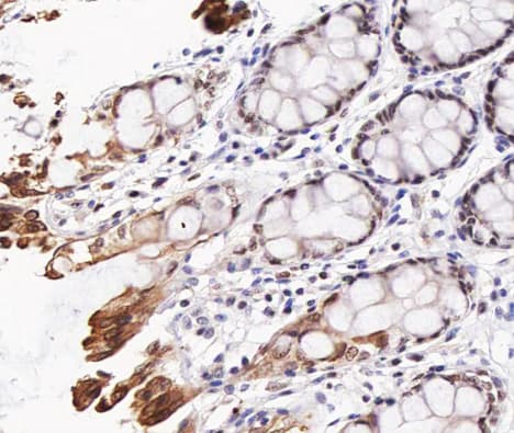 AKT1 Antibody (phospho-Thr308)
