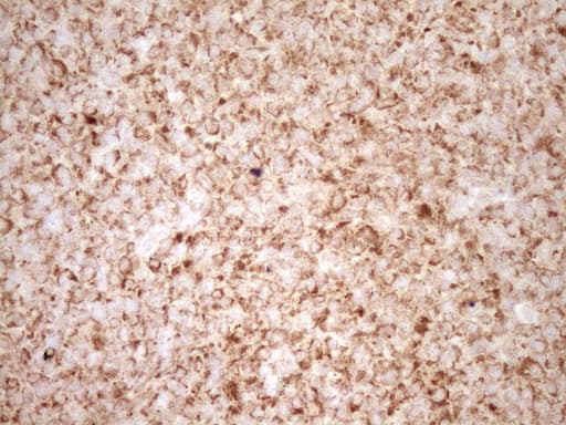 BCL2 / Bcl-2 Antibody (clone OTI9D3)