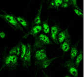Polyclonal Rabbit anti-Human BECN1 / Beclin-1 Antibody (IF, WB)