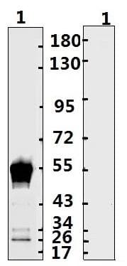 SARS-CoV-2 Nucleoprotein Antibody