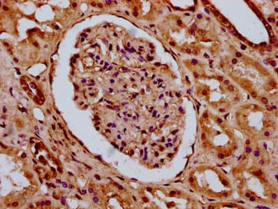 Polyclonal Rabbit anti-Human HIST1H4I Antibody (IHC)