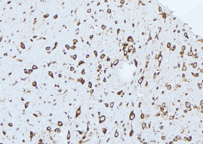 CPLX1 / Complexin 1 Antibody