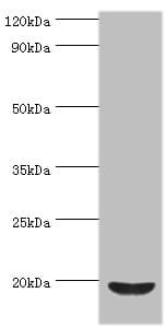 Polyclonal Rabbit anti-Human ACP1 / Acid Phosphatase Antibody (aa1-158, IHC, WB)