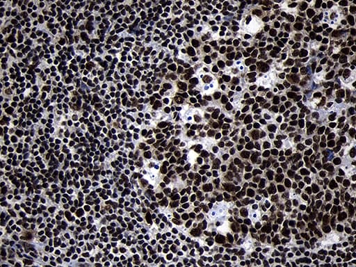 Monoclonal Mouse anti-Human HOXC4 Antibody (clone OTI2D5, IHC, WB)