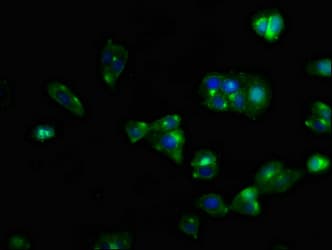 Polyclonal Rabbit anti-Human CXCR5 Antibody (IHC, IF)