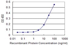 RPLP0 Antibody (clone 1B4)