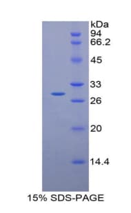 Rat MPS1 / TTK Protein (Recombinant His-T7)