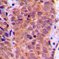 FOXO1 / FKHR Antibody (phospho-Ser319)