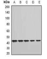 CFHR3 / CFHL3 Antibody