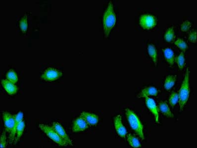 Polyclonal Rabbit anti-Human GUCY1A1 / GUCY1A3 Antibody (IHC, IF)