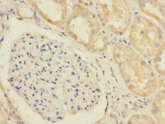 Polyclonal Rabbit anti-Human SLC1A7 / EAAT5 Antibody (IHC, IF)