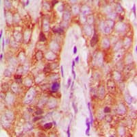 MMP13 Antibody (N-Terminus)