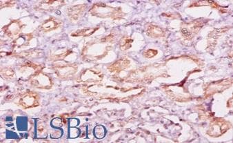 CAST / Calpastatin Antibody (HRP)