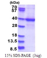 Human STRADA / LYK5 Protein (Recombinant His)