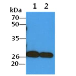 COMMD7 Antibody (clone AT49B5)