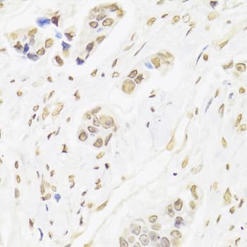 Polyclonal Rabbit anti-Human XRCC6 / Ku70 Antibody (IHC, IF, WB)