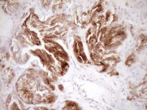 Monoclonal Mouse anti-Human KRT19 / CK19 / Cytokeratin 19 Antibody (clone OTI6A8, aa240-390, IHC, WB)