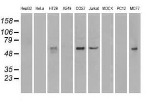 NRBP1 / NRBP Antibody (clone OTI6C11)
