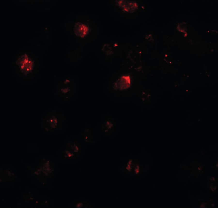 IHC-plus™ Polyclonal Rabbit anti-Human ZNF687 Antibody (IHC, IF, WB)