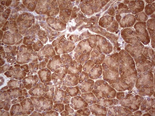 UBE2D2 / UBCH5B Antibody (clone OTI1D11)