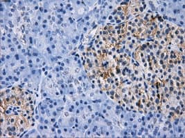 Monoclonal Mouse anti-Human RPA2 / RFA2 / RPA34 Antibody (clone OTI7F4, IHC, WB)
