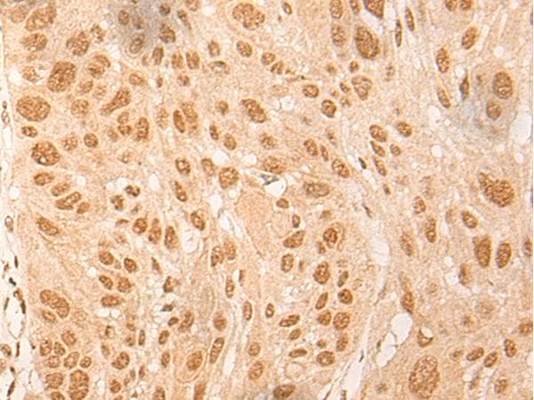 D-Binding Protein / DBP Antibody