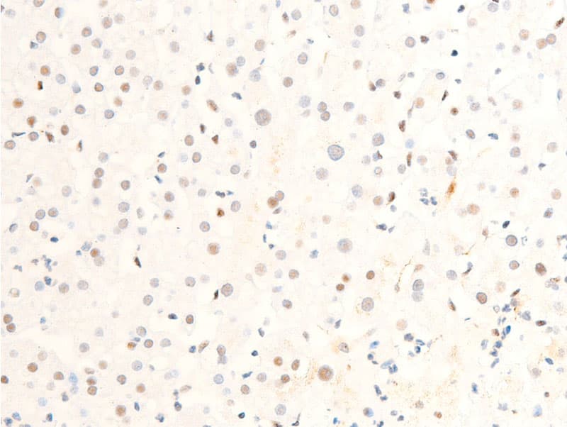 Polyclonal Rabbit anti-Human MYC / c-Myc Antibody (phospho-Ser62, IHC, IF, WB)