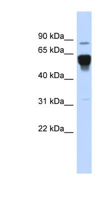 Polyclonal Rabbit anti-Human NR4A2 / NURR1 Antibody (aa503-552, WB)