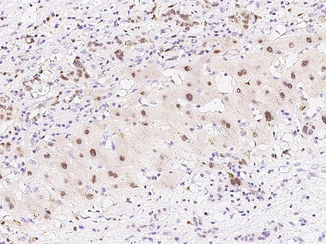 PRPK / TP53RK Antibody (Preservative Free)