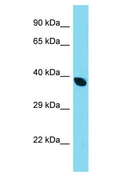 DCDC2B Antibody (aa212-261)