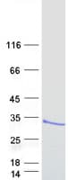 Human ARL14 Protein (Recombinant Myc-DDK (Flag))