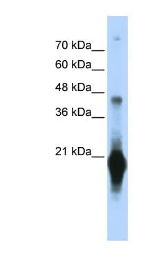 C17orf49 Antibody (C-Terminus)