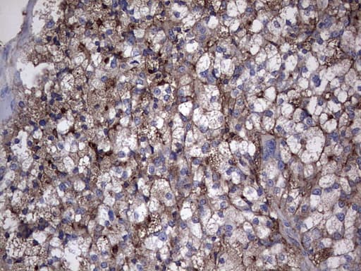 TG / Thyroglobulin Antibody (aa20-358, clone OTI8F1)